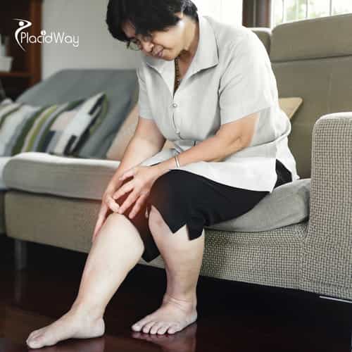 Treating Osteoarthritis with Stem Cells at MexStemCells Clinic: Why Mexico City is the Go-To Destination